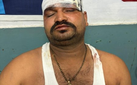 खूनी सड़क पर अनियंत्रित होकर पलटी बोलेरो कार,कई हुए घायल