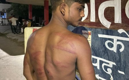 दबंगो के हौसले बुलंद, युवक को मार मार कर किया लाल