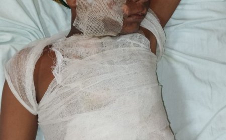 हाईटेंशन लाइन की चपेट में से दस बालक झुलसा