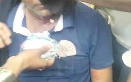 शिकायत करने गए व्यक्ति को लाठी डंडों से पीटा