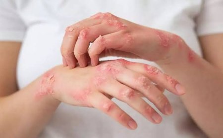 जनपद में शुरू हुआ कुष्ठ रोगी खोजी अभियान