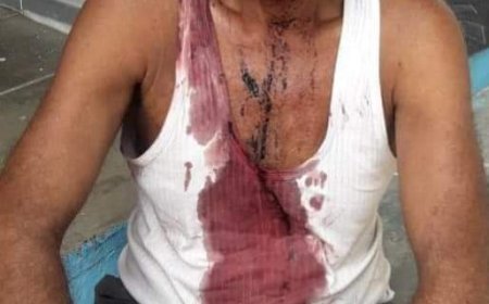 रास्ते से गुजर रहे युवक को कुल्हाड़ी मारकर किया घायल