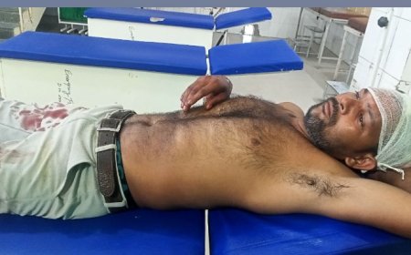 बाइक सवार चार अज्ञात लोगों ने पत्थर मारकर युवक का सिर फोड़ा