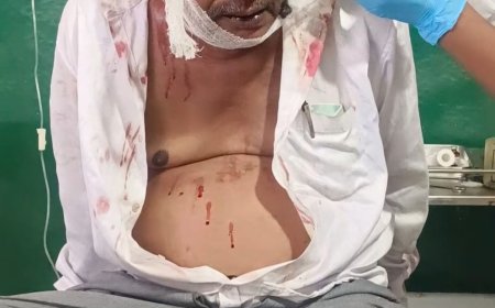 नसेड़ी पुत्र ने किया पिता पर प्राण घातक हमला, पुलिस को दी तहरीर