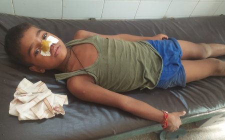 हिंसक जानवर के हमले में बालक घायल, जिला अस्पताल रेफर