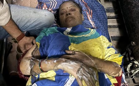 आग से झुलसकर गम्भीररूप से घायल हुए दम्पत्ति, मेडिकल कॉलेज रिफर