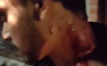 शराब पीने के लिए रुपये न देने पर मारपीट कर किया घायल