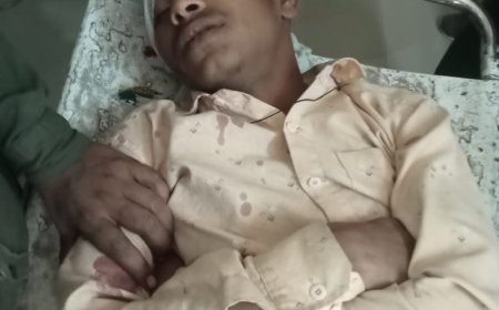 सड़क दुर्घटना में वाइक सवार दो युवक घायल