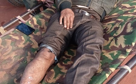 तीव्र गति व लापरवाही से चलती बस ने बाइक सवार को टक्कर मारी, गंभीर घायल