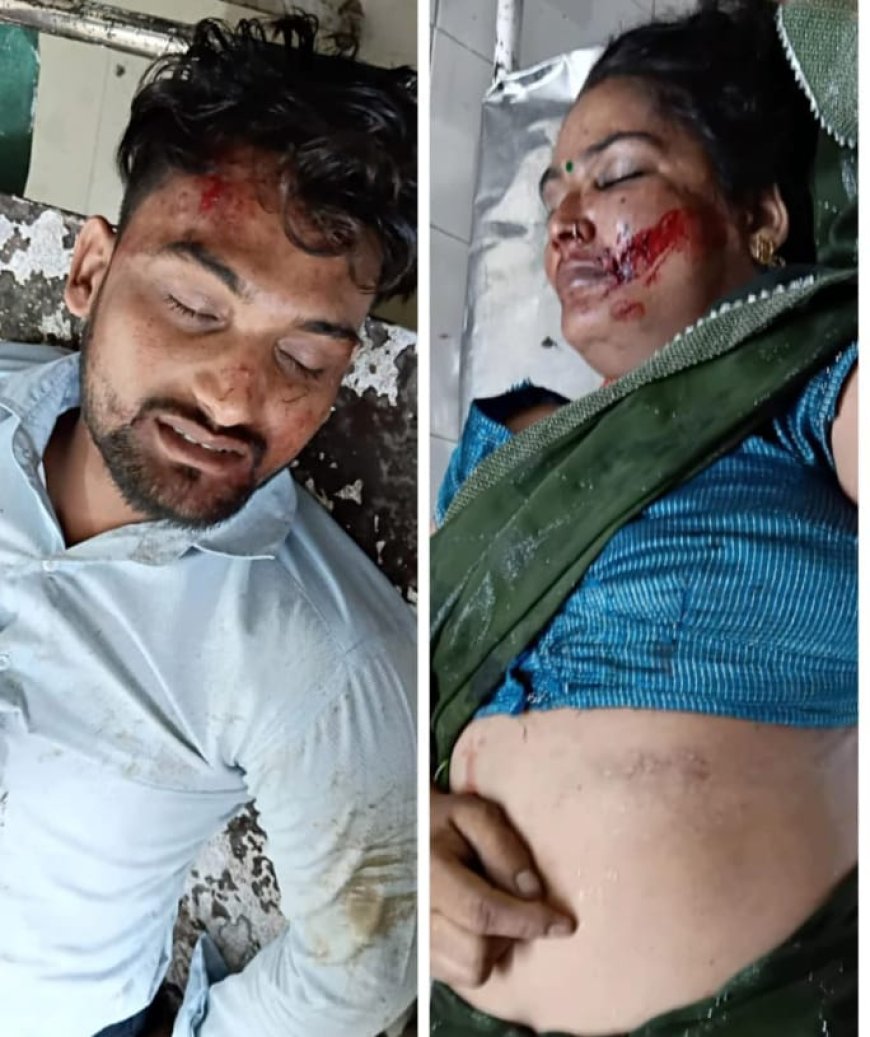 रेलवे ओवरब्रिज से नीचे गिर कर बाइक सवार मां की मौत बेटा घायल