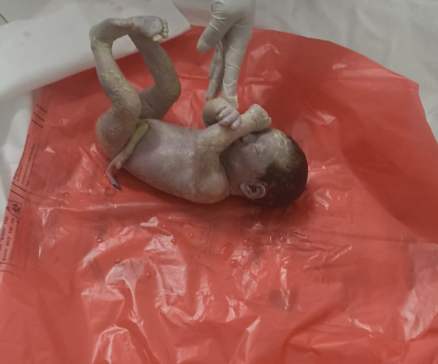 जिला अस्पताल में लापरवाही की इंतहा- इमरजेंसी वार्ड के डस्टबिन में मिला नवजात भ्रूण