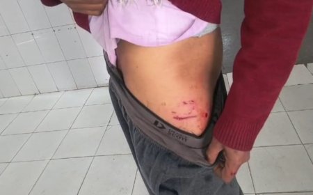 पागल कुत्ते ने दौड़ा दौड़ाकर लोगों को किया जख्मी