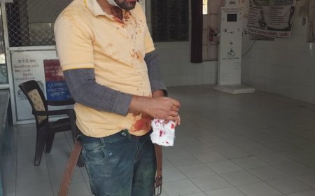 सड़क हादसे में तीन लोग गम्भीर रूप से हुए घायल