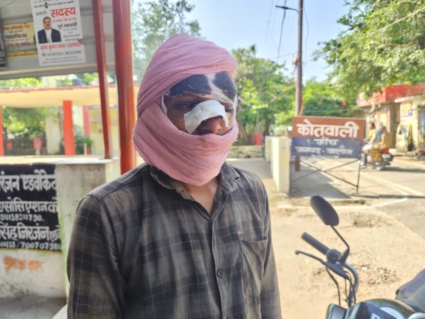 ईंट पत्थर से मारकर किया घायल पुलिस ने लिखा मुकद्दमा